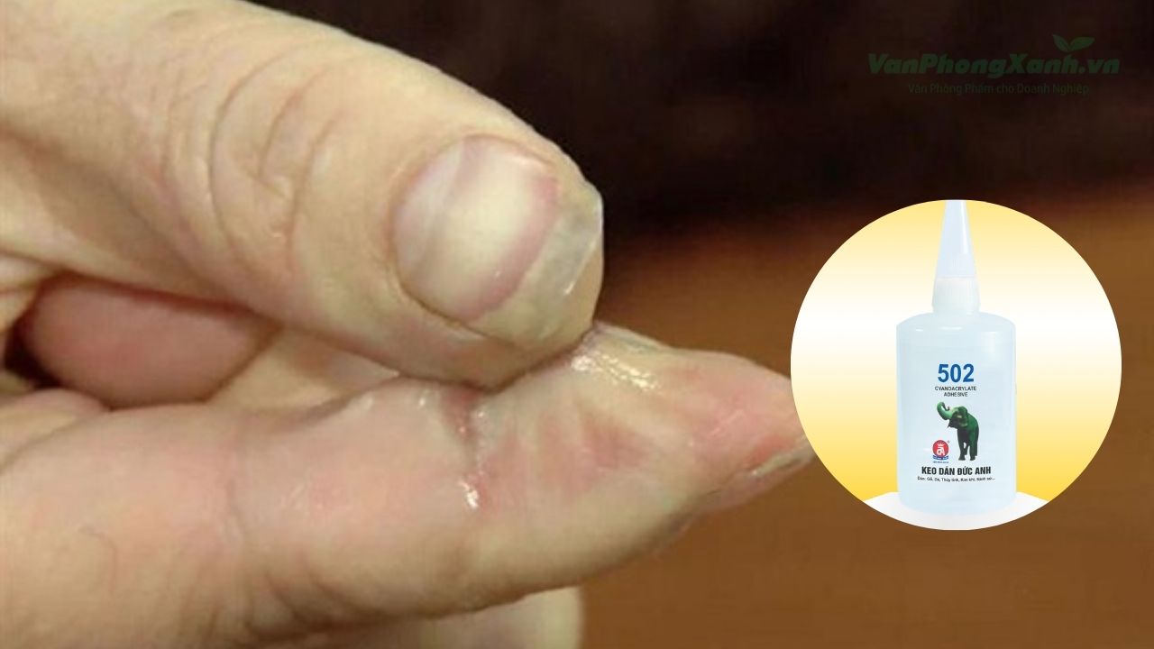 Cách gỡ keo 502 dính tay cực nhanh mà không đau rát Cách gỡ keo 502 dính tay cực nhanh mà không đau rát